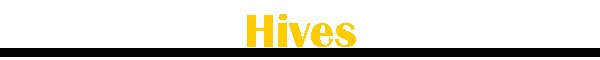 Hives